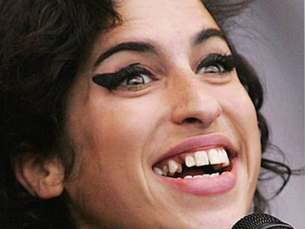 Amy Winehouse en route to the dentist perhaps?